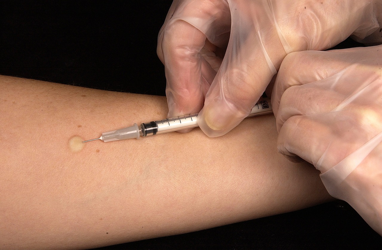 ¿Cómo se transmite la tuberculosis del olivo?