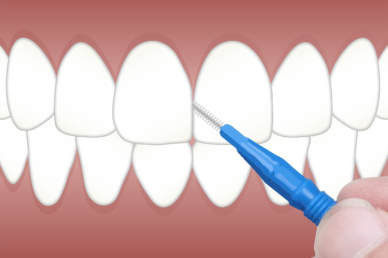 ¿Qué es un tepe y cuánto mide?